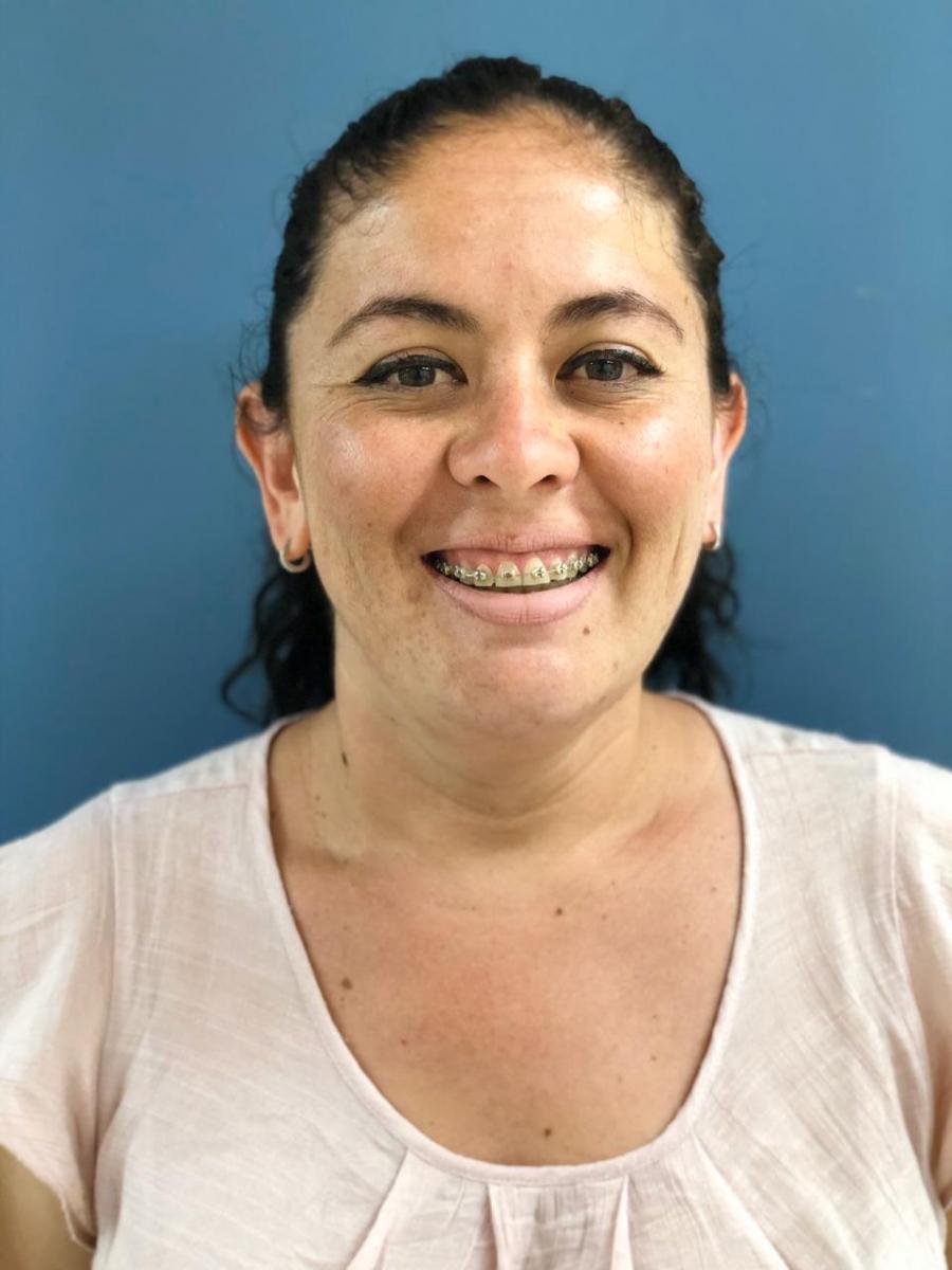 Cirugía tiroidea poBerenice Ramos Santana, 34 años, Cirugía tiroidea por la boca (TOETVA) SIN CICATRIZr la boca (TOETVA) SIN CICATRIZ